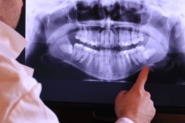 Best After-Hours Emergency Dentist in Denison, IA